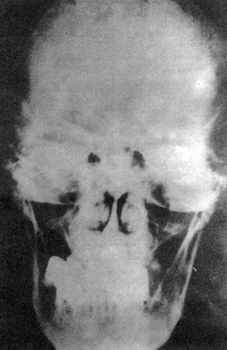 Homo Гитлер: психограмма диктатора - _41.jpg