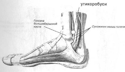 Aнатомия жизни и смерти. Жизненно важные точки на теле человека - _170.jpg