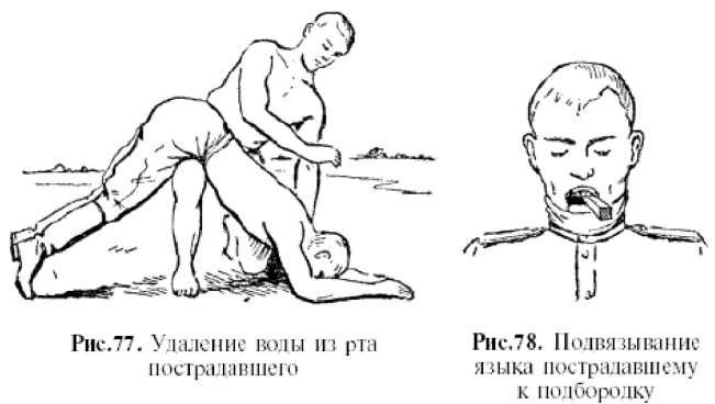 Физическая подготовка разведчика - _62.jpg