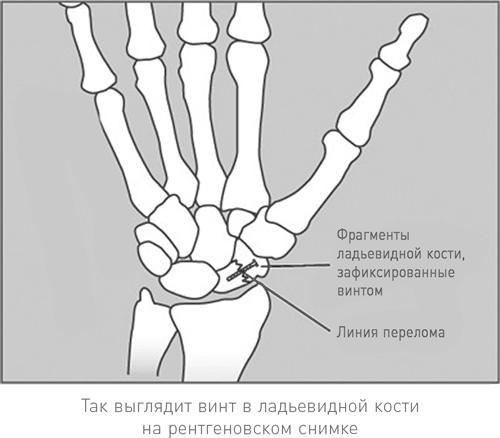 Осторожно, спорт! О вреде бега, фитнеса и других физических нагрузок  - i_003.png