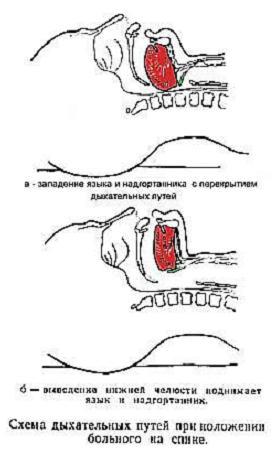 Курс лекций по реаниматологии и интенсивной терапии - _1.jpg