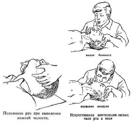 Курс лекций по реаниматологии и интенсивной терапии - _3.jpg