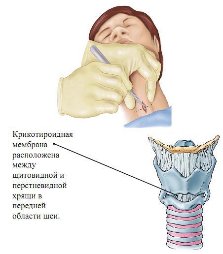 Курс лекций по реаниматологии и интенсивной терапии - _4.jpg