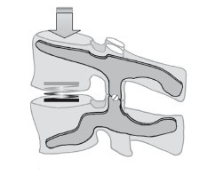 Диагностика и лечение позвоночника. Уникальная система доктора А. М. Уриа - i_037.jpg