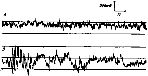 Мозг в электромагнитных полях - i_009.png