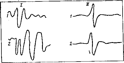 Мозг в электромагнитных полях - i_016.png