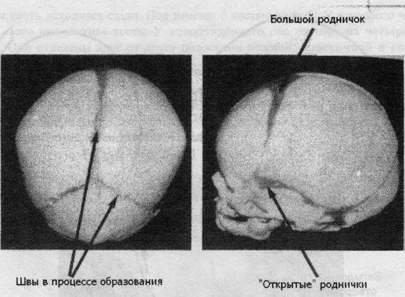 Остеопатия для малышей - image028.jpg