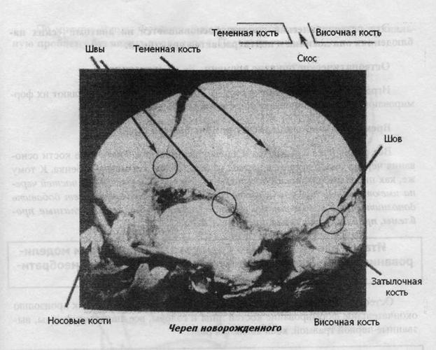 Остеопатия для малышей - image029.jpg