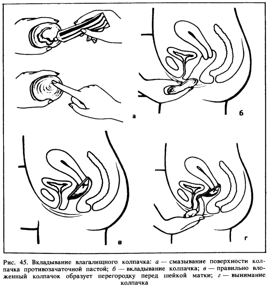 Искусство любви - _47.png