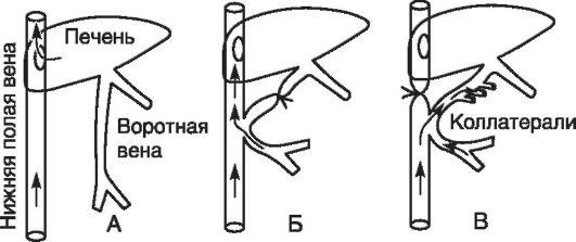 Патофизиология. Том 2 - _76.jpg