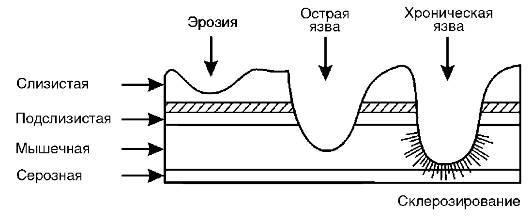 Патофизиология. Том 2 - _71.jpg