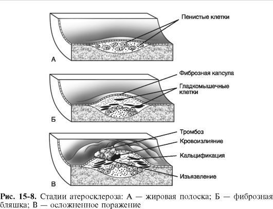 Патофизиология. Том 2 - _38.jpg