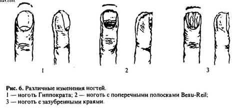 Гомеопатия. Часть II. Практические рекомендации к выбору лекарств - i_028.jpg