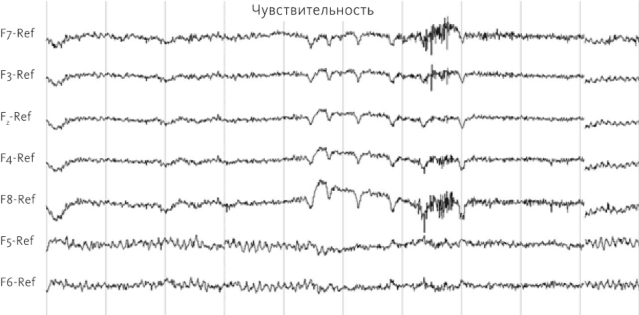 Нейромаркетинг в действии. Как проникнуть в мозг покупателя - i_004.png