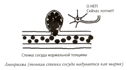 Мой инсульт был мне наукой. История собственной болезни, рассказанная нейробиологом - _103012.png