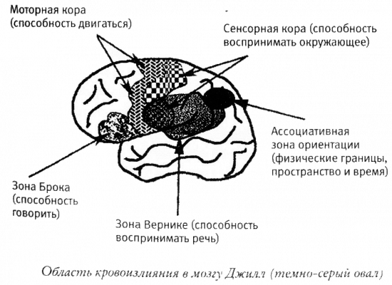 Мой инсульт был мне наукой. История собственной болезни, рассказанная нейробиологом - _121308.png