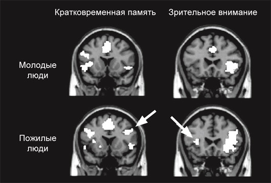 Мозг на пенсии. Научный взгляд на преклонный возраст - i_014.jpg