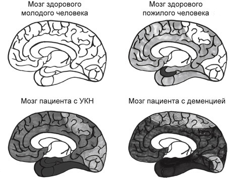 Мозг на пенсии. Научный взгляд на преклонный возраст - i_015.jpg