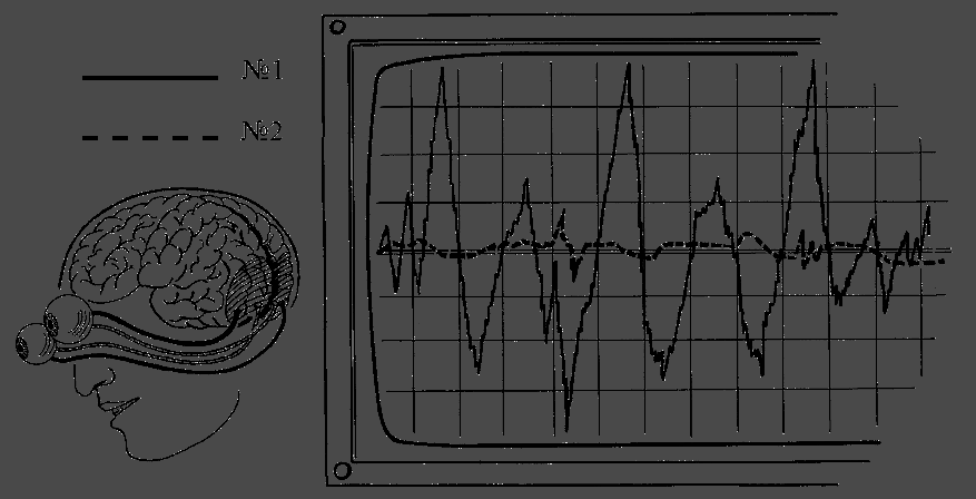 Интуиция дурака, или Как достать халявный миллион решений - i_019.png