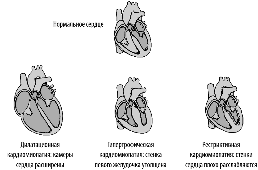 Сердце и сосуды. Большая энциклопедия здоровья - _320.png