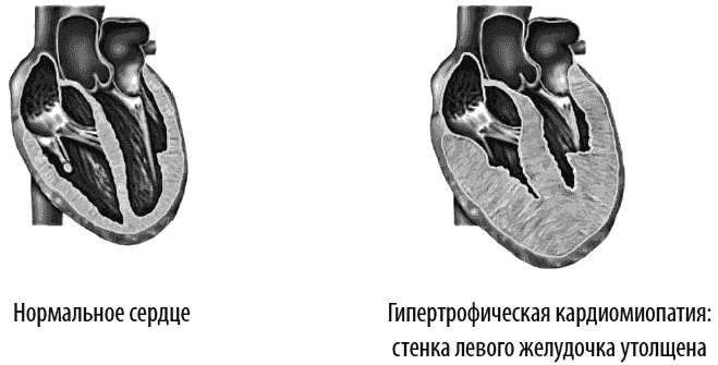 Сердце и сосуды. Большая энциклопедия здоровья - _321.png