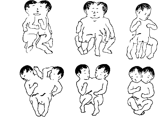 Что надо знать до брака и в браке - i_007.png