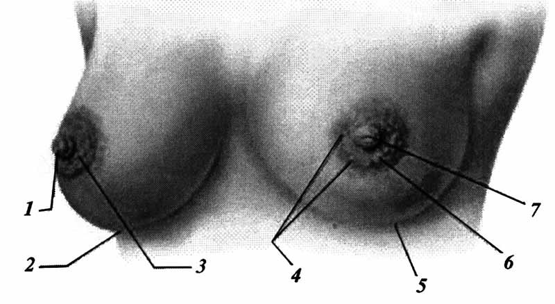 Мастопатия и гинекомастия - ris2.jpg