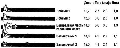 Квантовое Прикосновение: Исцеляющая энергия - i_066.jpg