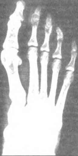 Тело танцора - i_093.jpg