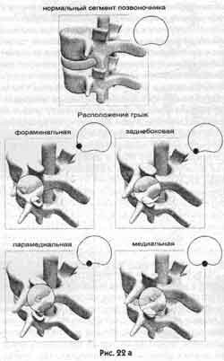 Победить боль в спине - i_015.jpg