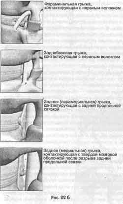 Победить боль в спине - i_016.jpg