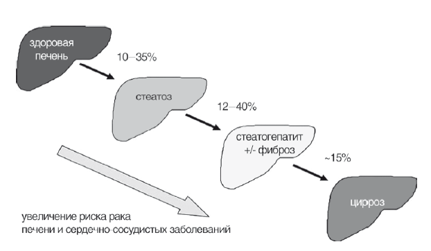 Неалкогольная жировая болезнь печени - i_005.png