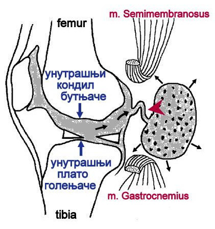 Болезнь Бехтерева. Хроника заболевания (2012-2017) - _20.jpg