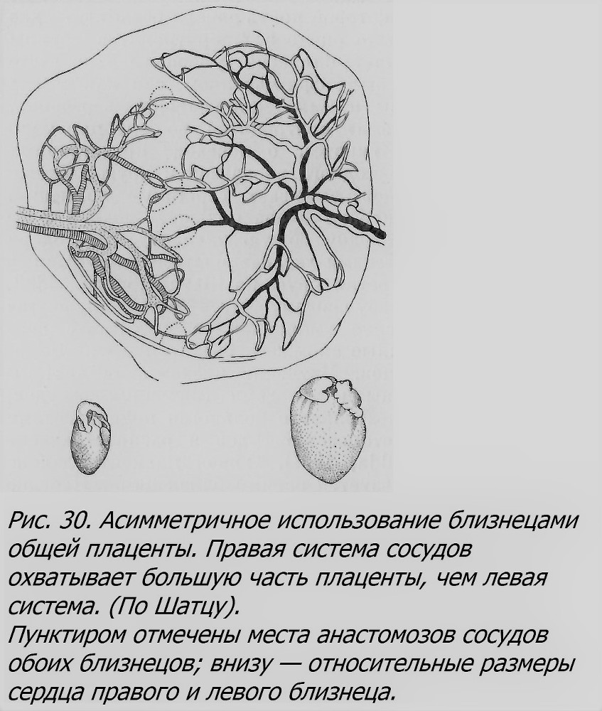 Близнецы - _032_1.jpg