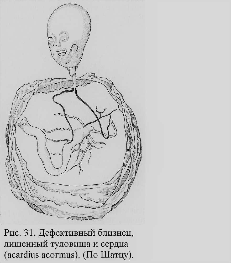 Близнецы - _032_2.jpg