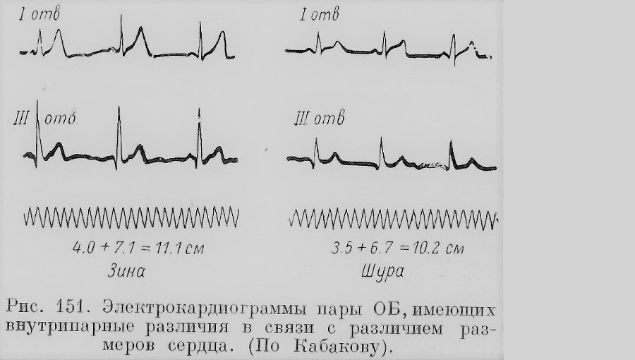 Близнецы - _113_4.jpg