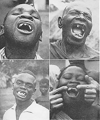 Челюсти. Научное исследование о взаимосвязи между зубами, мозгом и кишечником + 40-дневный план питания, который поможет вернуть в норму здоровье ротовой полости и сформировать иммунитет к кариесу - i_006.jpg