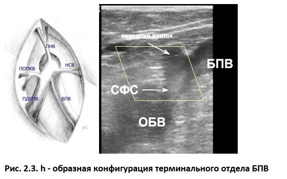 Ультразвуковая анатомия вен нижних конечностей - _2.3.jpg