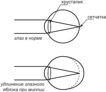 История очков, или Вооруженный взгляд - i_003.jpg