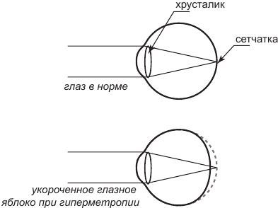 История очков, или Вооруженный взгляд - i_005.jpg