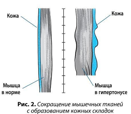 Гимнастика для лица. Практики для сохранения красоты и молодости - i_006.jpg