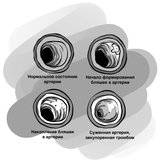 Биохакинг без фанатизма. Как прожить долгую полноценную жизнь - i_023.jpg