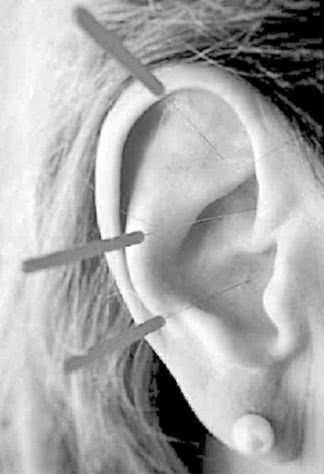 Чуткое ухо. Что может рассказать о вашем здоровье ушная раковина - i_009.jpg