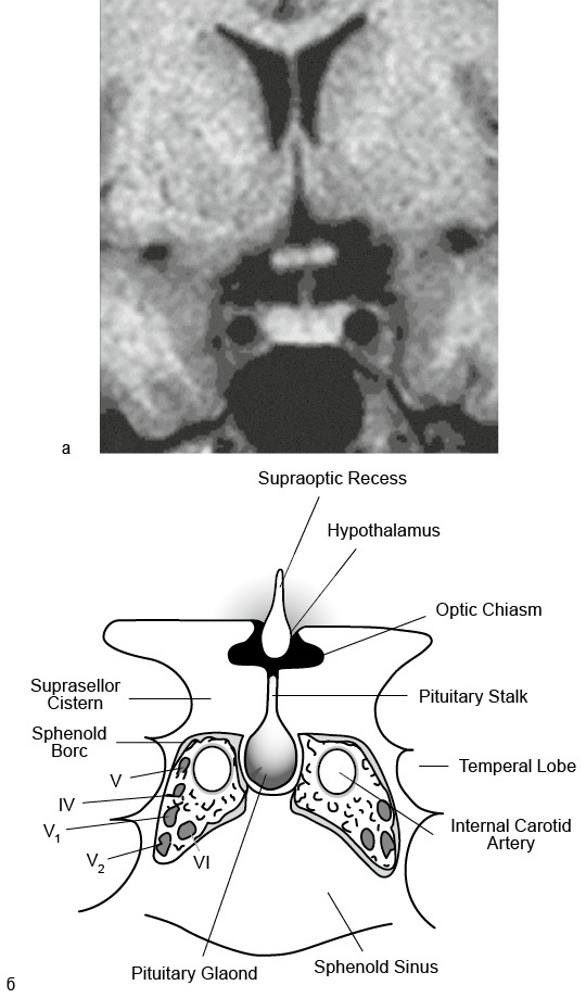 Эндокринные синдромы и болезни. Руководство для врачей. - i_020.jpg
