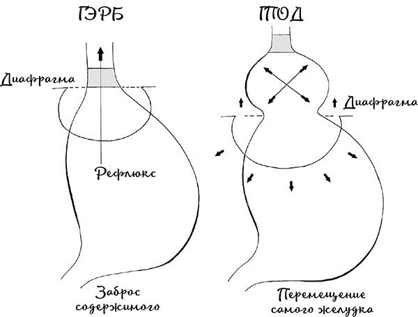 Гастро-книга. Пищеварение вдоль и поперек - i_014.jpg