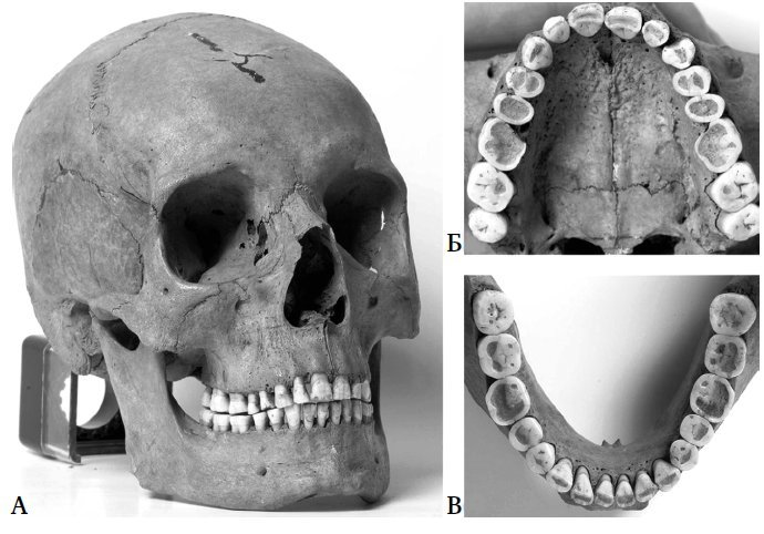 Укус эволюции. Откуда у современного человека неправильный прикус, кривые зубы и другие деформации челюсти - i_006.jpg