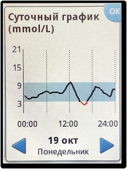 Профессиональное и флеш мониторирование гликемии на помповой инсулинотерапии и без нее - i_020.jpg
