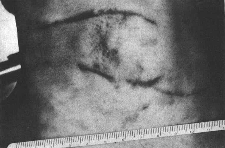 Сексуальные маньяки. Психологические портреты и мотивы - i_016.jpg