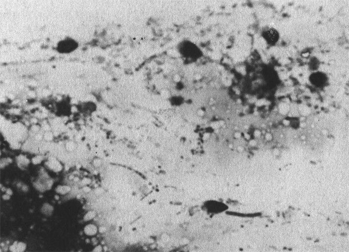 Сексуальные маньяки. Психологические портреты и мотивы - i_017.jpg