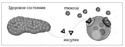 Как победить диабет. Руководство по питанию и образу жизни - i_002.jpg